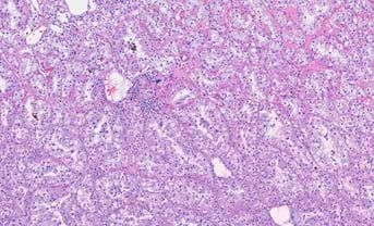 Pathomics to study the biological microenvironment