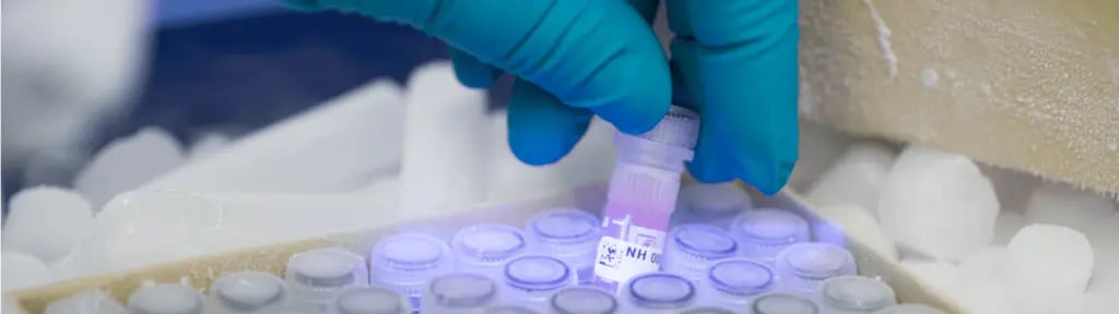 Approche holistique echantillons