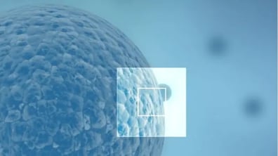 Choosing the Right Partner: Special Sample Needs For In Vitro Diagnostics