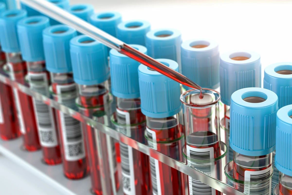 Biospecimens-viablecells-pbmc-samples