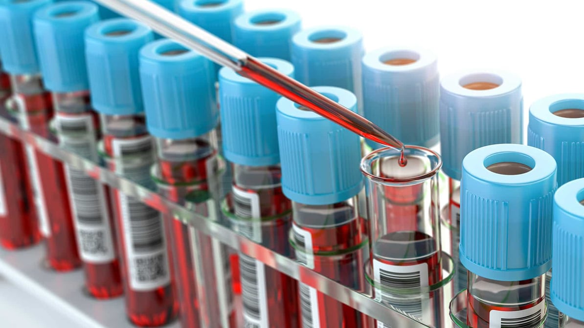 clinical-sample-kitting (1)