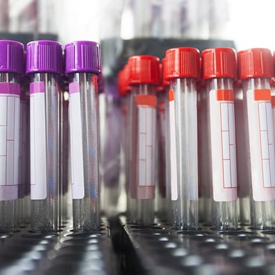 clinical-sample-kitting-services_card-thumbnail