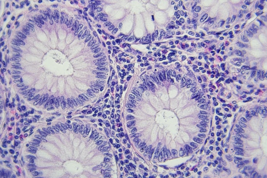 IHC image