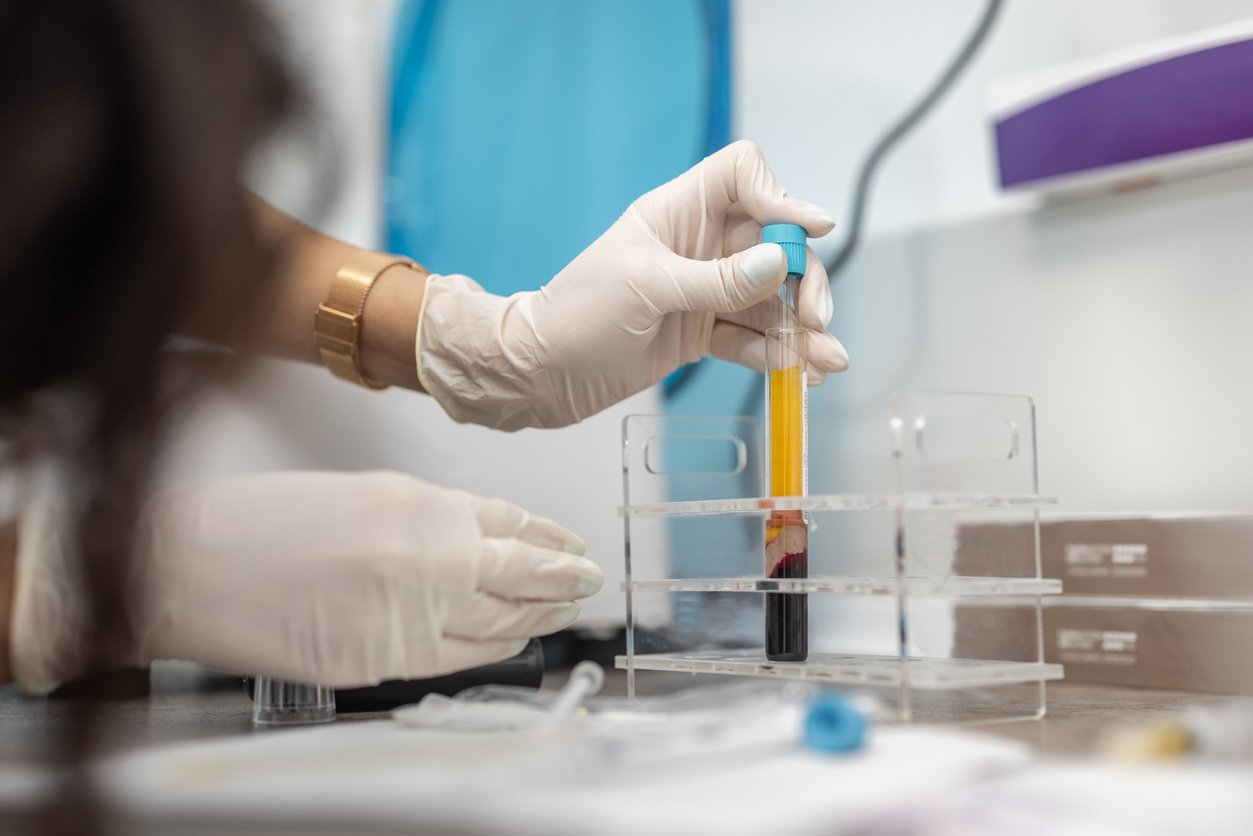 additional plasma services