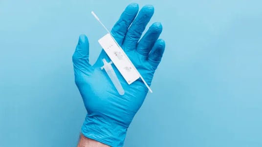 COVID-19 Home Testing: Looking Back at the Journey to Authorization