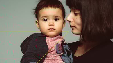 Case Study: Phase 3 Ultra-Rare Pediatric Trial in Classic Galactosemia