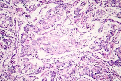 tissue-biospecimens_card-thumbnail