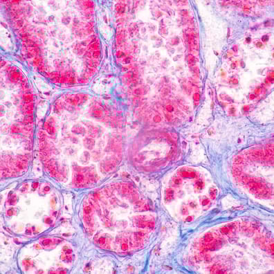 tissue-cross-reactivity_card-thumbnail