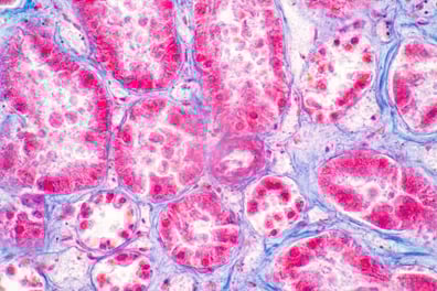 tissue-cross-reactivity_header