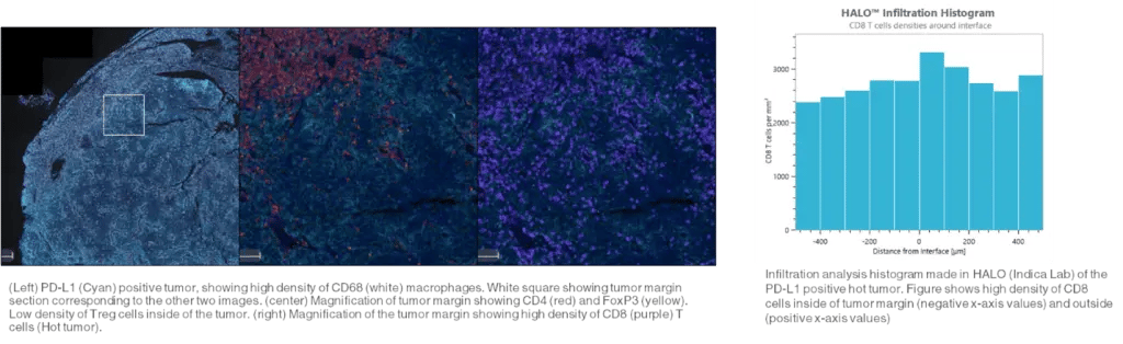Analyse infiltration 1024x314
