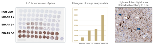 PFM-Figure-1.-Qualification-of-TMA-using-IHC-for-expression-of-p-tau-651x193